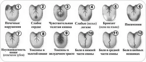 як лікувати географічний язик