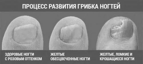 лікувати