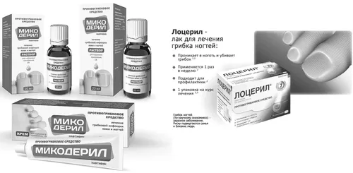 грибок
