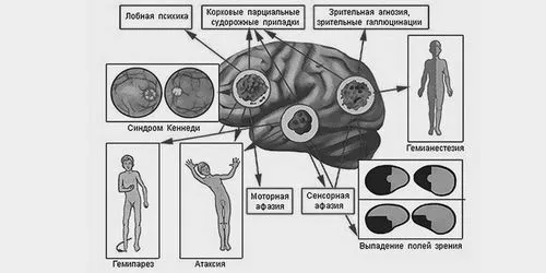 лікування