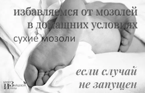 ногах