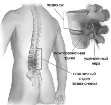 фізкультура