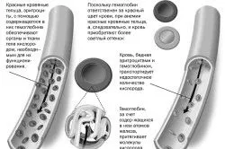 анемії