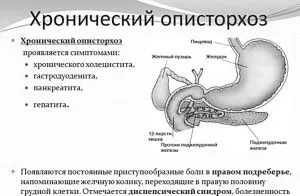 опісторхоз