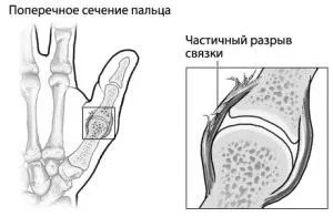 руці