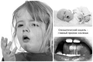 симптоми