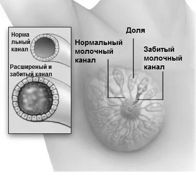 причини