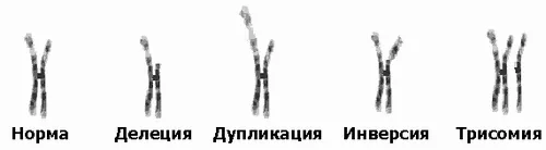 Як прибрати гематому під оком оком