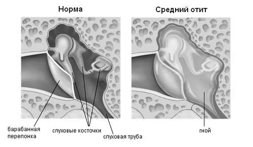 лимонний сік