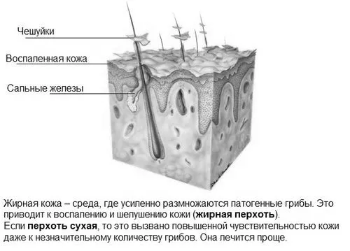голові