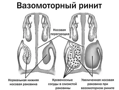 затяжний