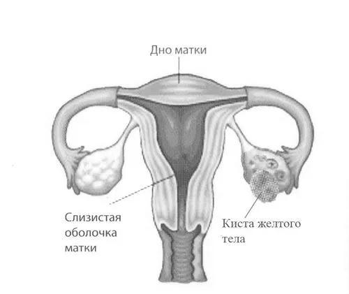 лікування