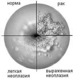 матки