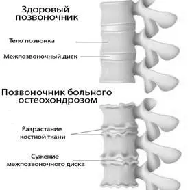 засобами