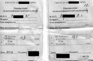 лікування