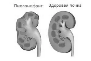 пшоно для нирок