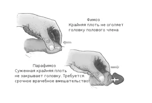 лікування