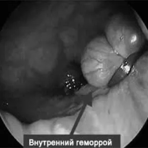 стадії