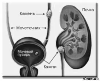 умовах