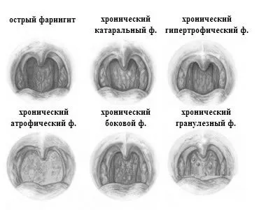 лікування