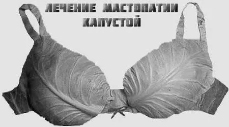 мастопатії
