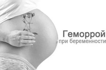 лікування