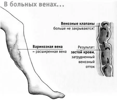 яблучним