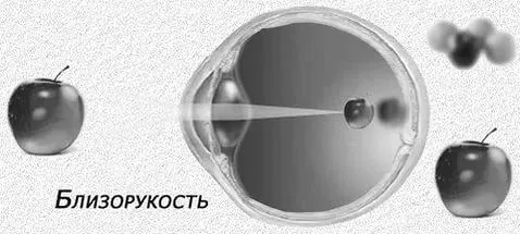 лікування