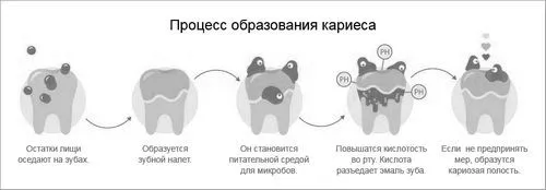 карієсу