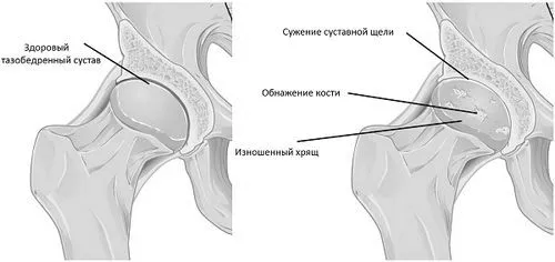 лікування