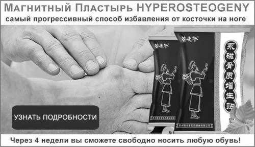 як вилікувати кісточку на нозі без операції