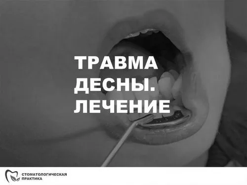 травму
