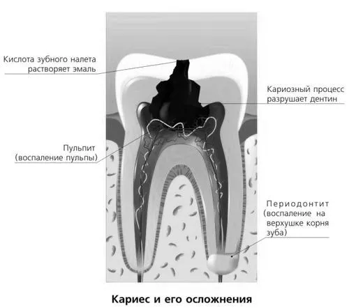 лікування