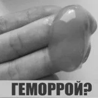 геморої