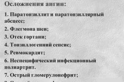 Морозиво при ангіні чи можна вилікувати гланди морозивом