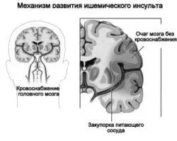 як вилікувати нестабільність шиї