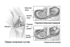 симптоми