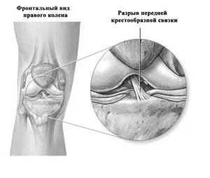 передня