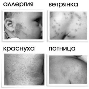 грудничка