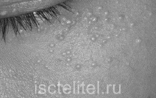 причини