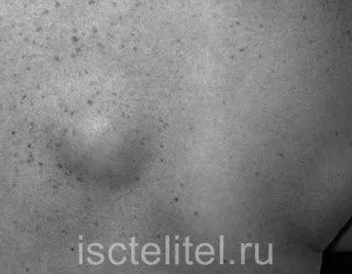 причини