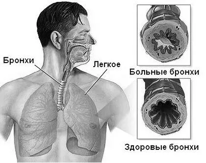 вранці