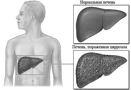 причини