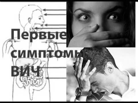 Перші симптоми вич симптоми