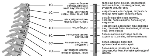 як лікувати остеохондроз 1 ступеня