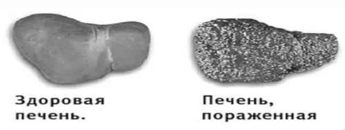 гепатит д діагностика
