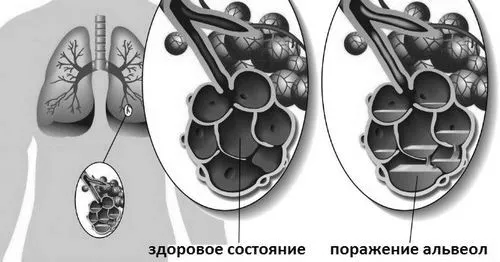 симптоми