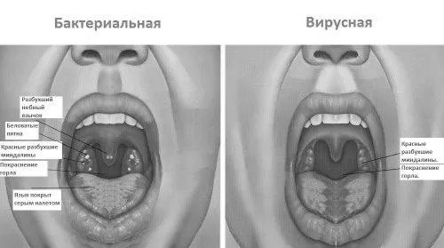 патології