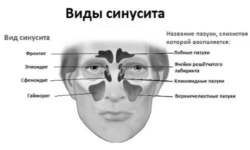 гнійний