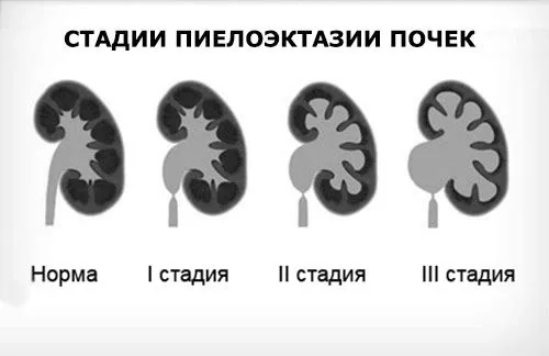 нирок
